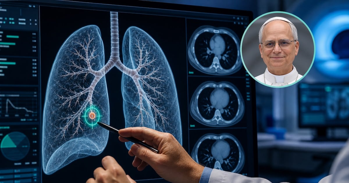 El nódulo pulmonar de tres milímetros que preocupa al Papa: por qué los médicos recomiendan operarlo igual